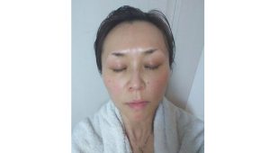 エトヴォス化粧水シミが薄くなる？レビュー検証画像（顔）